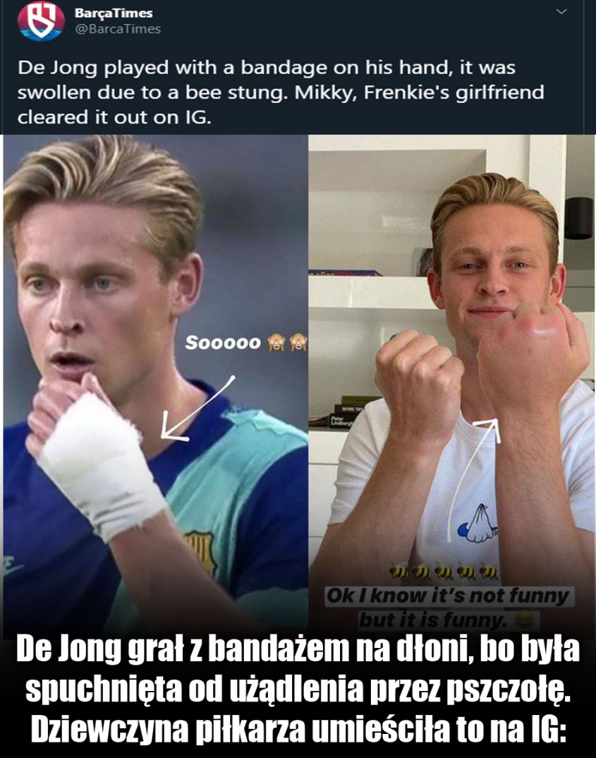 DLATEGO Frenkie de Jong grał z bandażem!